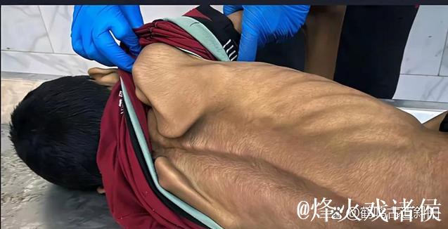 埃贝尔谈帕夫洛维奇受伤情况：疑似肌肉问题